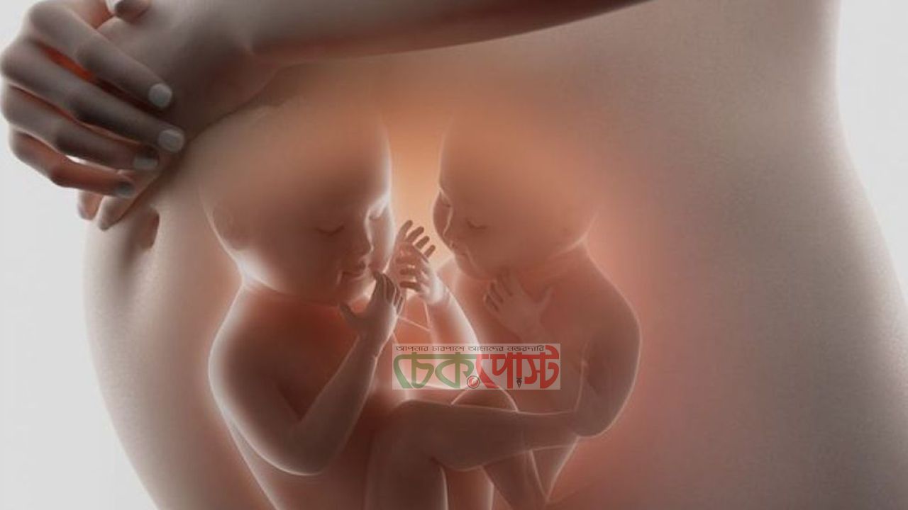 যমজ সন্তান কেন হয়? জেনে নিন কারণ ও ঝুঁকি