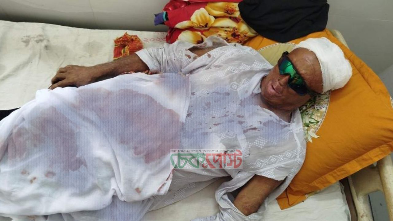 গোপালগঞ্জে সাবেক ইউপি চেয়ারম্যানের ওপর হামলা, গুরুতর আহত ২