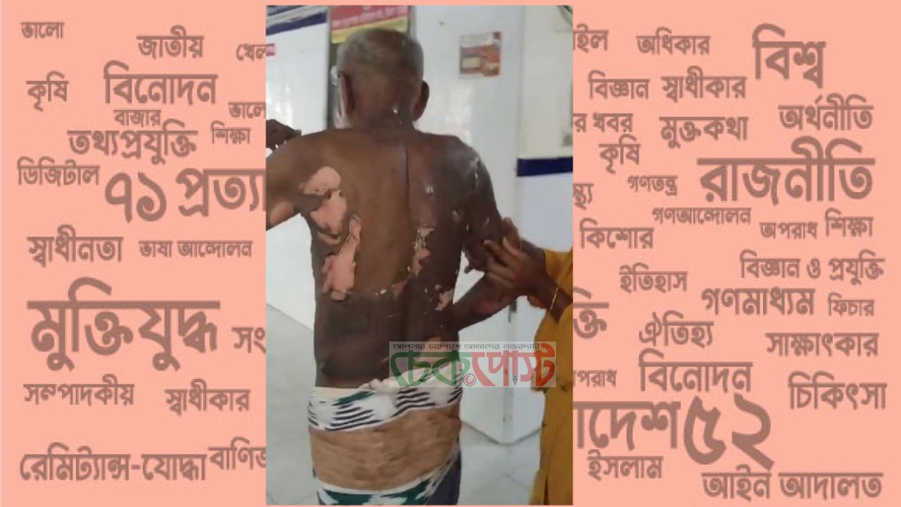 সৈয়দপুরে পেট্রোল ঢেলে আগুন, বৃদ্ধ দগ্ধ হয়ে আশঙ্কাজনক