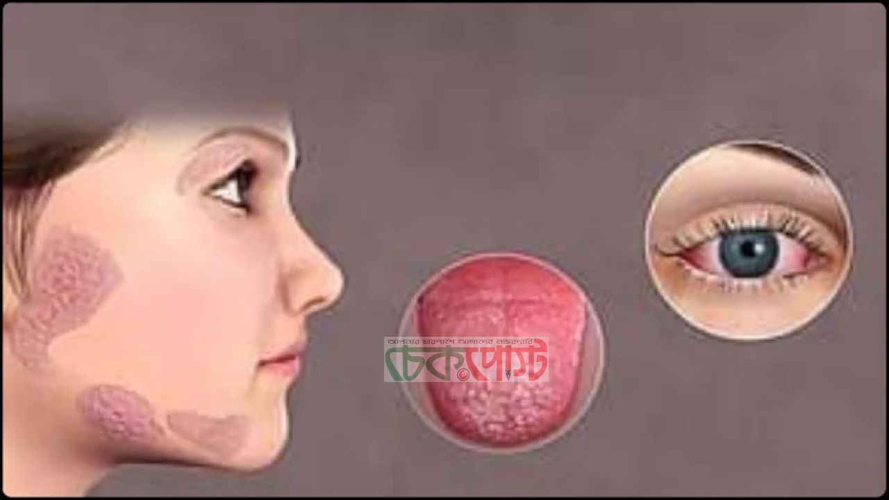 পানি খেলেও মুখ-গলা শুকায়? হতে পারে বড় রোগের সংকেত