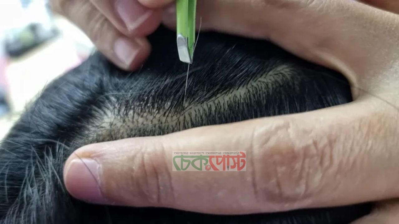 পাকা চুল বা দাড়ি তুললে কি গুনাহ? যা বলেছে হাদিস